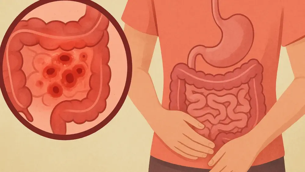 Coccidinia: Conheça os Sintomas e Tratamentos Disponíveis