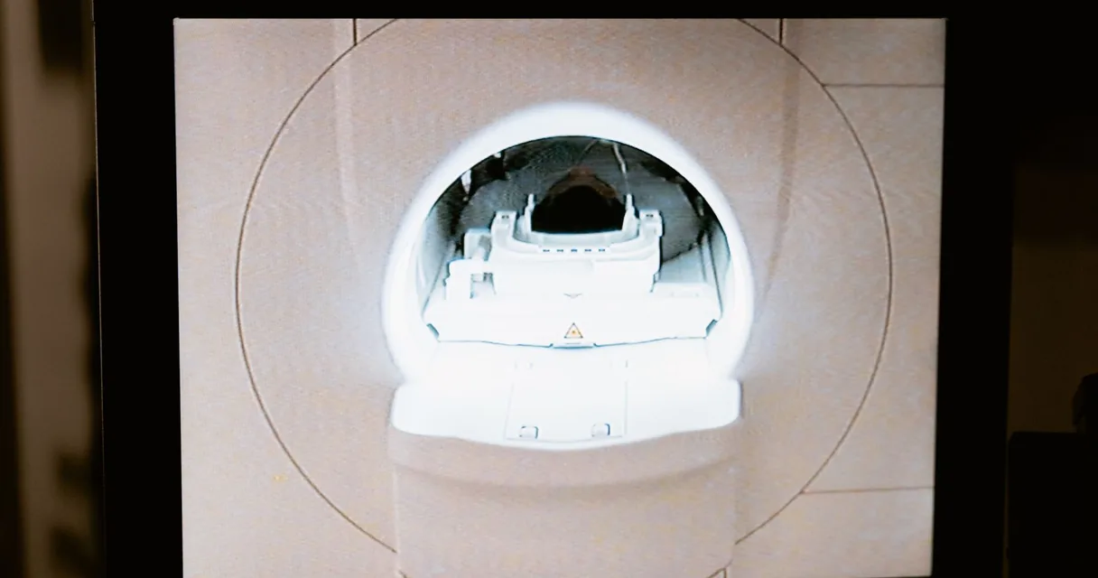 Equipamento de PET scan em hospital